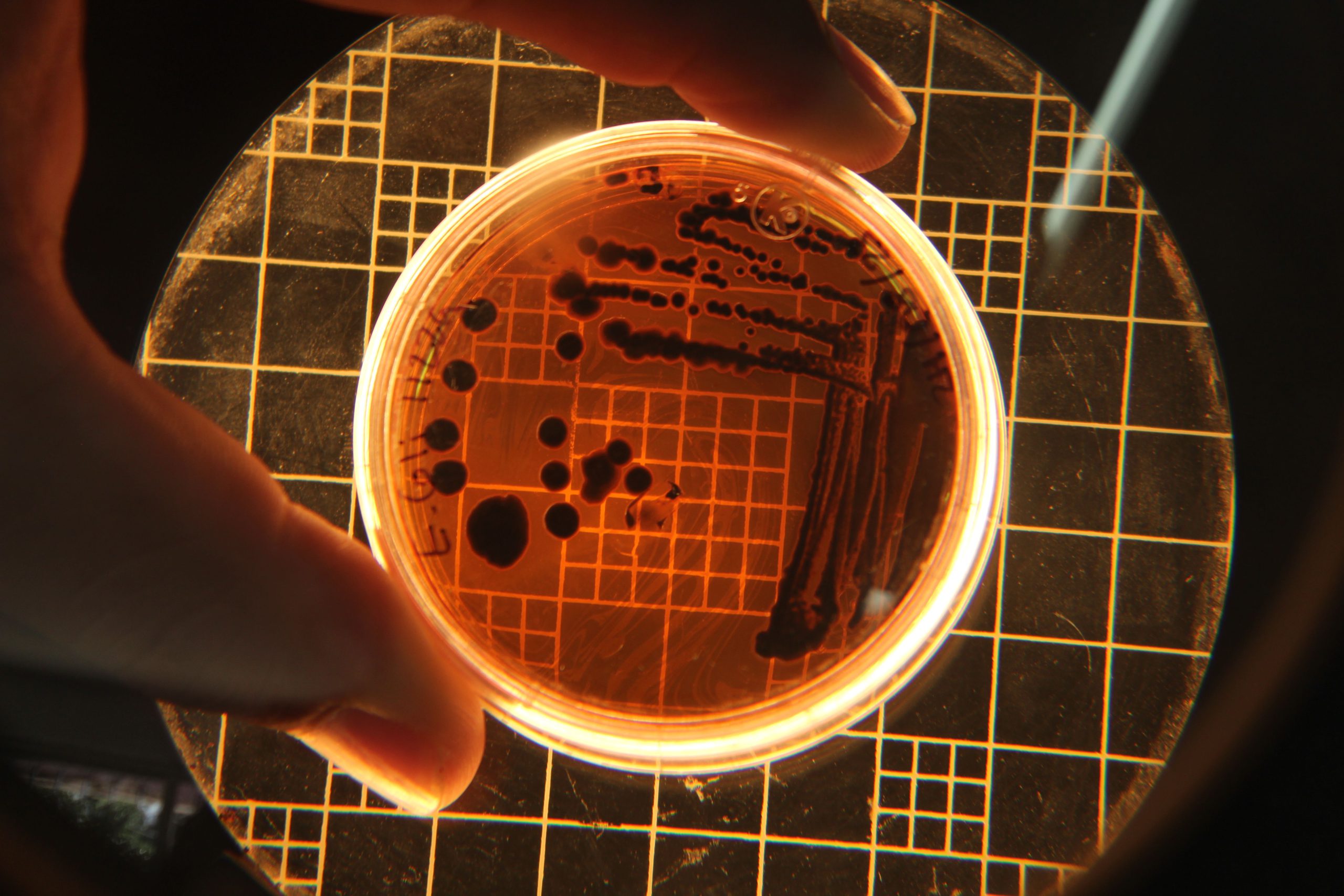 Colonias de bacterias en placa de Petri para estudio de superbacterias