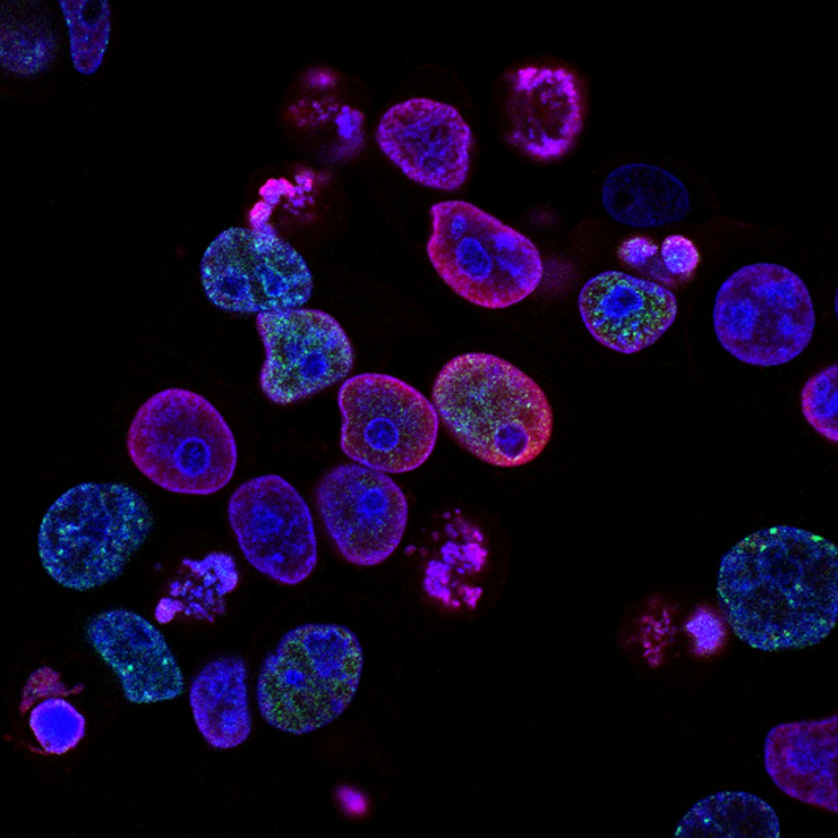 Células madre sanguíneas al microscopio - investigación de la Universidad de Tokio sobre la proteína MLKL y el envejecimiento celular