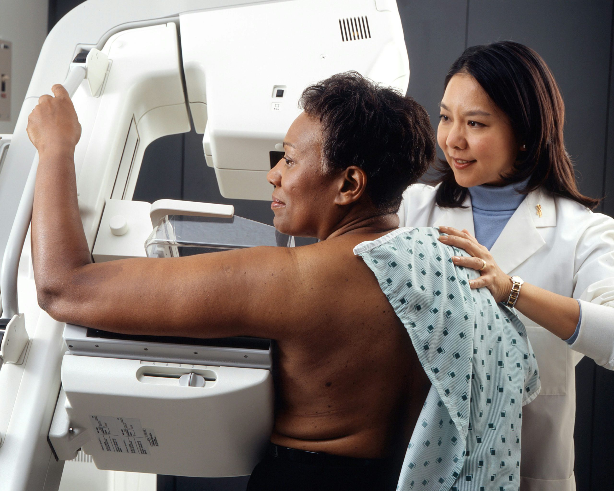 Mamografía para detección precoz de cáncer de mama con IA