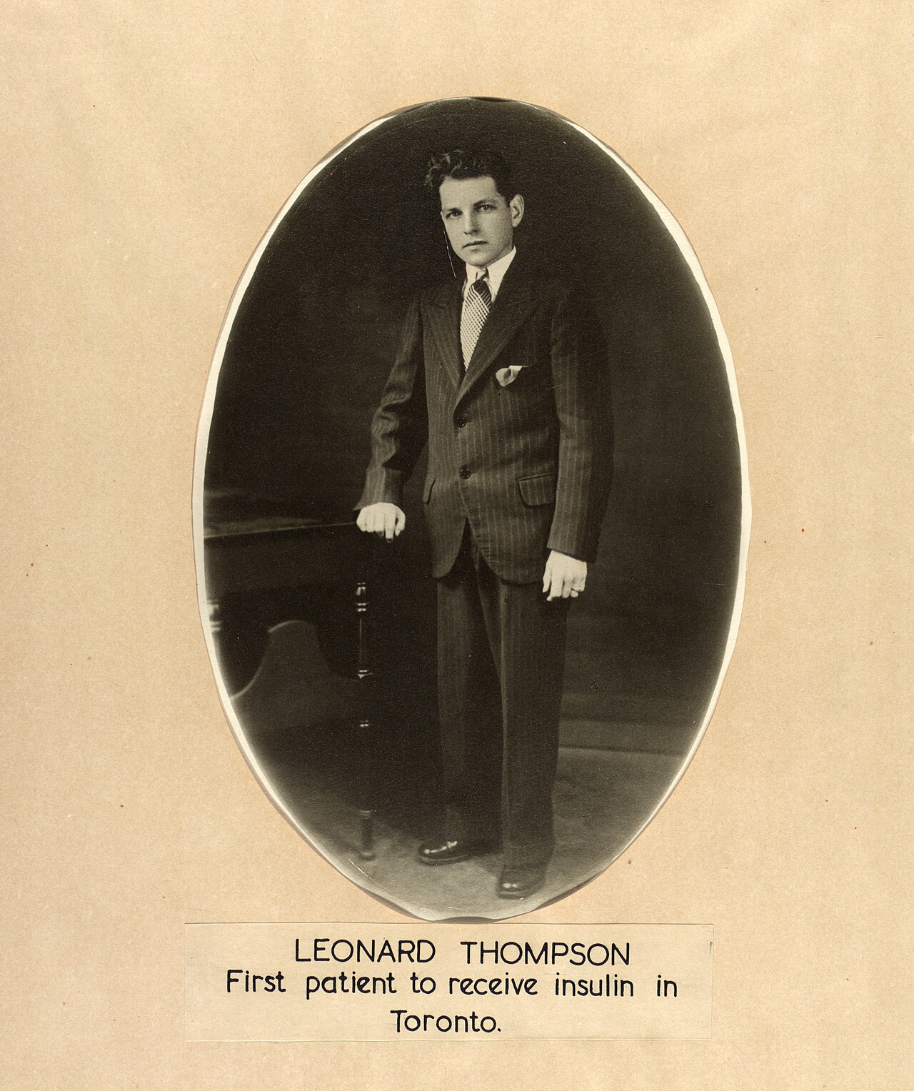 Imagen histórica de Leonard Thompson, el primer paciente tratado con insulina