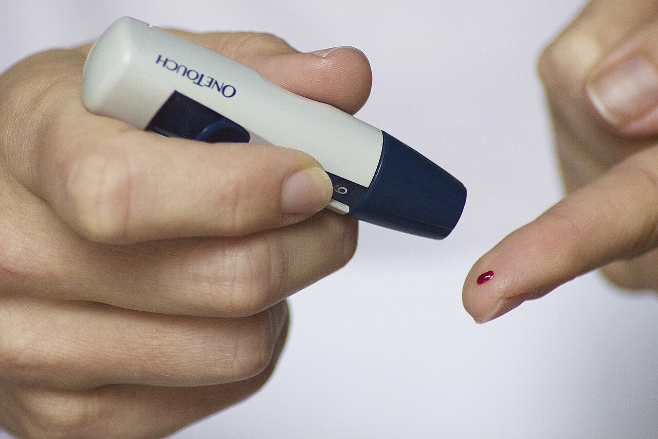 Medición de glucemia capilar con lanceta en el dedo de una persona, control de la diabetes