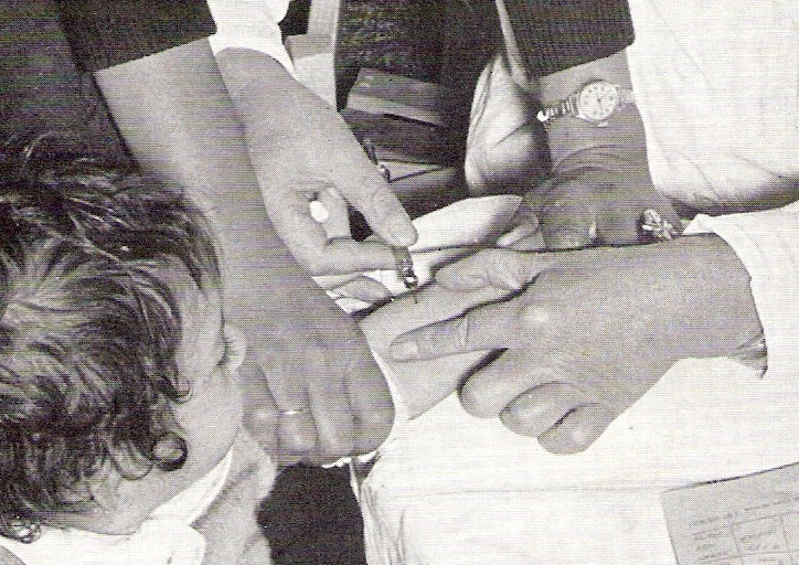 Vacunación contra la polio en la década de 1950