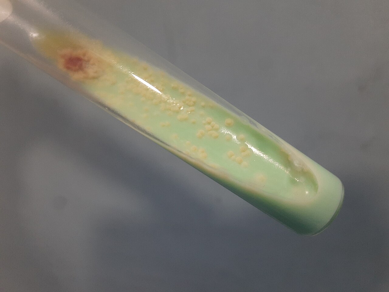 Tuberculosis en África: 2,4 millones de personas sin diagnosticar 6 Cultivo de Mycobacterium tuberculosis en medio Löwenstein-Jensen en un laboratorio de diagnóstico