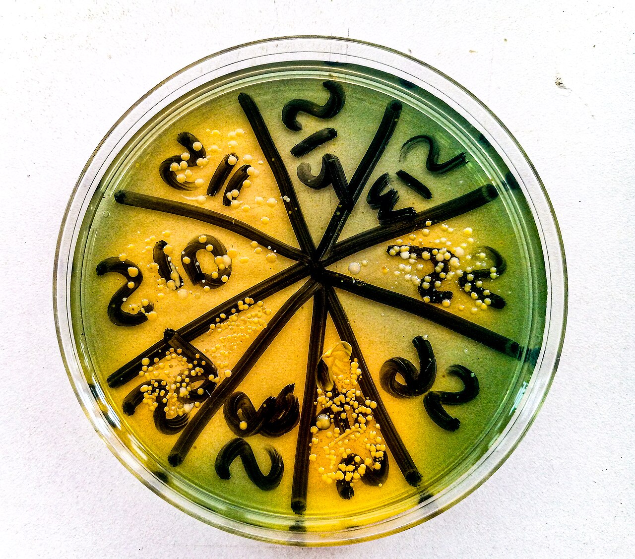 Cultivo de orina con colonias de Staphylococcus aureus tras 24 horas de incubación en un laboratorio clínico