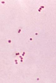 Meningitis en África: 21.526 casos y 971 muertes en 2025 2 Micrografía de Neisseria meningitidis, la bacteria que causa la meningitis meningocócica endémica del cinturón africano
